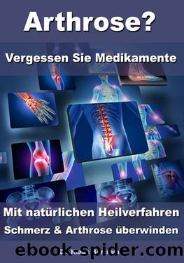 Arthrose? – Vergessen Sie Medikamente – Mit natürlichen Heilverfahren Schmerz & Arthrose überwinden by Dr. Klaus Bertram