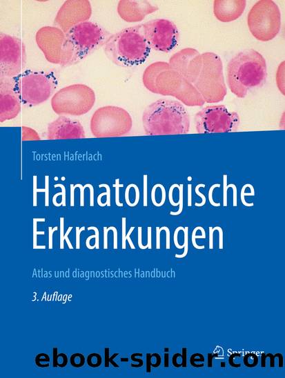 Hämatologische Erkrankungen by Torsten Haferlach