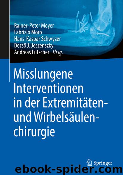 Misslungene Interventionen in der Extremitäten- und Wirbelsäulenchirurgie by Rainer-Peter Meyer & Fabrizio Moro & Hans-Kaspar Schwyzer & Dezsö J. Jeszenszky