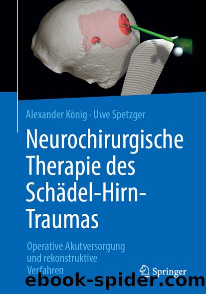 Neurochirurgische Therapie des Schädel-Hirn-Traumas by Alexander König & Uwe Spetzger