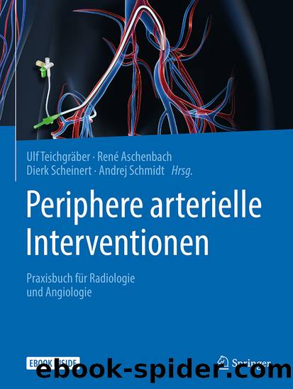 Periphere arterielle Interventionen by Ulf Teichgräber René Aschenbach Dierk Scheinert & Andrej Schmidt