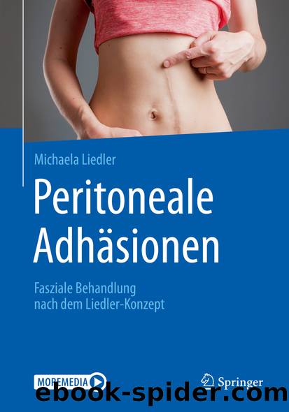 Peritoneale Adhäsionen by Michaela Liedler