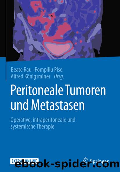 Peritoneale Tumoren und Metastasen by Beate Rau Pompiliu Piso & Alfred Königsrainer
