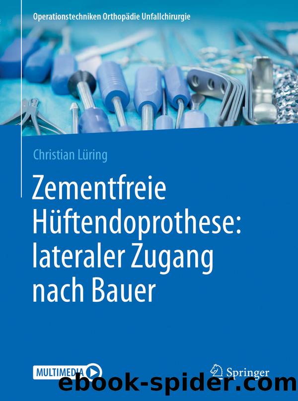 Zementfreie Hüftendoprothese: lateraler Zugang nach Bauer by Christian Lüring